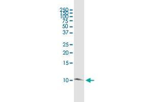 TIMM8B polyclonal antibody (A01).