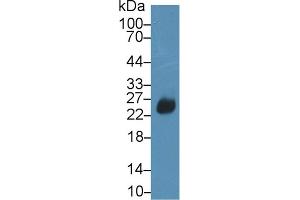 Western Blot; Sample: Rat Spleen lysate; Primary Ab: 2µg/ml Rabbit Anti-Rat SIT1 Antibody Second Ab: 0.