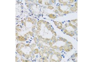 Immunohistochemistry of paraffin-embedded human stomach using ATPIF1 antibody at dilution of 1:100 (x40 lens). (ATPase Inhibitory Factor 1 anticorps)