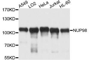 Western blot analysis of extracts of various cell lines, using NUP98 antibody. (NUP98 anticorps  (AA 621-920))