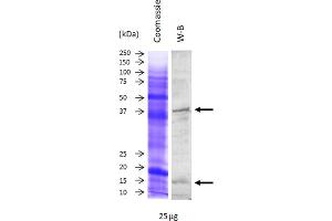 Image no. 1 for anti-Superoxide Dismutase 1, Soluble (SOD1) antibody (ABIN3197496) (SOD1 anticorps)