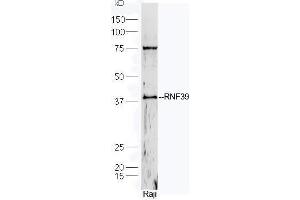 Human Raji cell lysates probed with Rabbit Anti-RNF39 Polyclonal Antibody, Unconjugated  at 1:5000 for 90 min at 37˚C. (RNF39 anticorps  (AA 182-230))