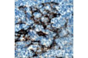 Immunohistochemical analysis of ZAP70 (pY319) staining in human tonsil formalin fixed paraffin embedded tissue section. (ZAP70 anticorps  (pTyr319))