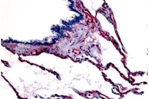 Human Respiratory Epithelium, Bronchial Smooth Muscle, and Alveoli (formalin-fixed, paraffin-embedded) stained with CAV1 antibody ABIN213405 at 3 ug/ml followed by biotinylated goat anti-rabbit IgG secondary antibody ABIN481713, alkaline phosphatase-strepta . (Caveolin-1 anticorps  (N-Term))