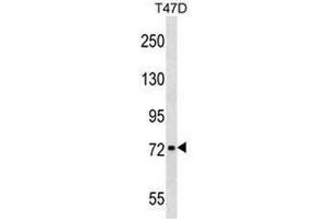 CHADL Antibody (Center) western blot analysis in T47D cell line lysates (35µg/lane). (CHADL anticorps  (Middle Region))