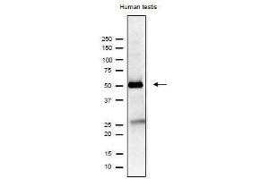 Western Blotting (WB) image for anti-Izumo Sperm-Egg Fusion 1 (IZUMO1) antibody (ABIN2452040) (IZUMO1 anticorps)