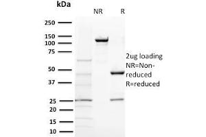SDS-PAGE Analysis Purified BAP1 Mouse Monoclonal Antibody (BAP1/2431). (BAP1 anticorps  (AA 191-326))