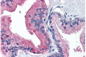 Human Prostate (formalin-fixed, paraffin-embedded) stained with B2M antibody ABIN364376 at 10 ug/ml followed by biotinylated anti-mouse IgG secondary antibody ABIN481714, alkaline phosphatase-streptavidin and chromogen. (beta-2 Microglobulin anticorps)