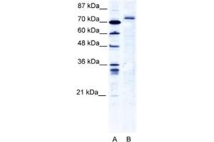 Western Blotting (WB) image for anti-Tripartite Motif Containing 9 (TRIM9) antibody (ABIN2461066) (TRIM9 anticorps)