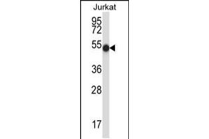 Western blot analysis in Jurkat cell line lysates (35ug/lane). (PNKP anticorps  (N-Term))