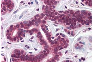 Human Breast: Formalin-Fixed, Paraffin-Embedded (FFPE)