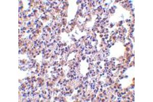 Immunohistochemistry of EIF2AK2 in rat lung tissue with EIF2AK2 polyclonal antibody  at 2. (EIF2AK2 anticorps  (C-Term))