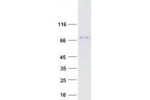 Validation with Western Blot