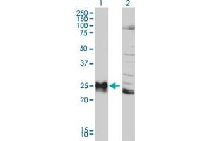 Western Blot analysis of HLA-DPB1 expression in transfected 293T cell line by HLA-DPB1 monoclonal antibody (M01), clone 6C6.