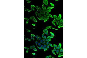 Immunofluorescence analysis of U2OS cells using Delta-sarcoglycan (Delta-sarcoglycan (SGCD)) antibody (ABIN6130325, ABIN6147699, ABIN6147701 and ABIN6217312).