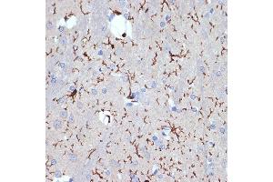 Immunohistochemistry of paraffin-embedded rat brain using //IB Rabbit mAb (9776) at dilution of 1:100 (40x lens). (Iba1 anticorps)