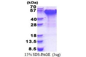 SDS-PAGE (SDS) image for Dynactin 2 (p50) (DCTN2) (AA 1-403) protein (His tag) (ABIN5853400) (Dynamitin Protein (AA 1-403) (His tag))