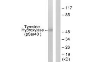 Western blot analysis of extracts from RAW264. (Tyrosine Hydroxylase anticorps  (pSer71))