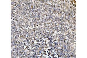 IHC analysis of EXOSC8 using anti-EXOSC8 antibody (ABIN7601850). (EXOSC8 anticorps  (AA 49-216))