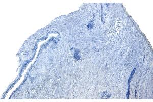 (ABIN5539753) Negative Control showing staining of paraffin embedded Human Prostate, with no primary antibody.