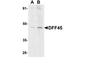 Western blot analysis of DFF45 in HeLa cell lysate with AP30290PU-N DFF45 antibody at (A) 1 and (B) 2 μg/ml. (DFFA anticorps  (N-Term))