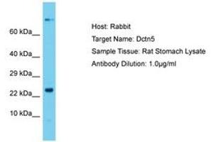 Image no. 1 for anti-Dynactin 5 (p25) (DCTN5) (N-Term) antibody (ABIN6750438) (DCTN5 anticorps  (N-Term))