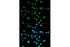 Immunofluorescence analysis of A549 cell using PAX2 antibody. (PAX2A anticorps)