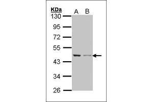 Western blot: Sample (30 µg of whole cell lysate). (beta Actin anticorps)
