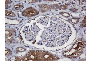 Immunohistochemistry (IHC) image for anti-Crystallin, alpha A (CRYAA) antibody (ABIN1498754)