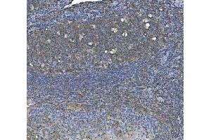 IHC analysis of eRF1/ETF1 using anti-eRF1/ETF1 antibody (ABIN7602626). (ETF1 anticorps  (AA 9-342))