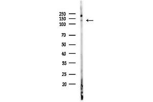 anti-Replication Factor C (Activator 1) 1, 145kDa (RFC1) (Internal Region) antibody