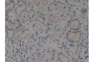 DAB staining on IHC-P; Samples: Human Kidney Tissue