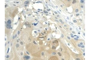 Detection of VF in Human Esophagus Tissue using Polyclonal Antibody to Visfatin (VF) (NAMPT anticorps  (AA 1-491))