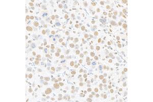 Immunohistochemistry (IHC) image for anti-Mediator Complex Subunit 1 (MED1) (AA 1550-1581) antibody (ABIN7455140) (Recombinant MED1 anticorps  (AA 1550-1581))