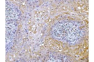 IHC analysis of ACLY using anti-ACLY antibody (ABIN4886416).