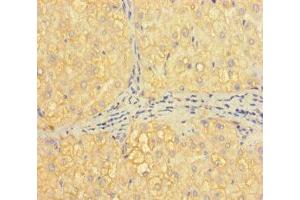 Immunohistochemistry of paraffin-embedded human liver tissue using ABIN7155373 at dilution of 1:100