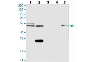 Western blot analysis of Lane 1: RT-4, Lane 2: U-251 MG, Lane 3: Human Plasma, Lane 4: Liver, Lane 5: Tonsil with CDR2L polyclonal antibody  at 1:250-1:500 dilution. (CDR2L anticorps)