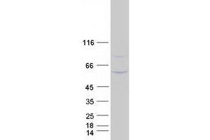 Validation with Western Blot