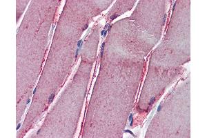 Anti-GSTM2 antibody IHC of human skeletal muscle. (GSTM2 anticorps  (AA 90-190))