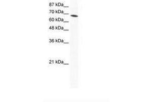 Image no. 1 for anti-DEAD (Asp-Glu-Ala-Asp) Box Polypeptide 1 (DDX1) (AA 671-720) antibody (ABIN202891) (DDX1 anticorps  (AA 671-720))