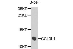 Western blot analysis of extracts of B-cell cells, using CCL3L1 antibody.