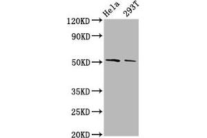 Western Blot Positive WB detected in: Hela whole cell lysate, 293T whole cell lysate All lanes: PLAGL2 antibody at 3. (PLAGL2 anticorps  (AA 324-469))