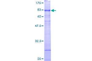 Image no. 1 for Ribosomal RNA Processing 9, Small Subunit (SSU) Processome Component, Homolog (RRP9) (AA 1-475) protein (GST tag) (ABIN1318915)