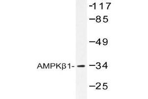 Western blot (WB) analysis of AMPKβ1 antibody in extracts from RAW264. (PRKAB1 anticorps)