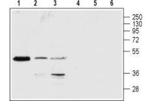 Western blot analysis of rat brain (lanes 1 and 4), Jurkat (lanes 2 and 5) and K-562 (lanes 3 and 6) lysates: - 1-3. (P2RY1 anticorps  (2nd Extracellular Loop))