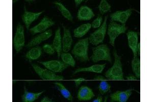 Immunofluorescence analysis of L929 cells using RAPGEF1 Polyclonal Antibody at dilution of 1:100 (40x lens). (GRF2 anticorps)