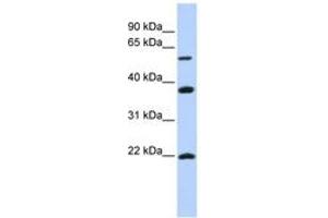 Image no. 1 for anti-Myosin Regulatory Light Chain Interacting Protein (MYLIP) (AA 360-409) antibody (ABIN6743161) (MYLIP anticorps  (AA 360-409))