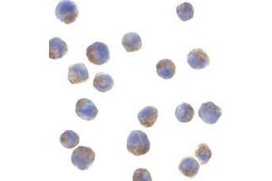 Immunohistochemistry of adiponectin in rat brain tissue with adiponectin antibody at 10 μg/ml.