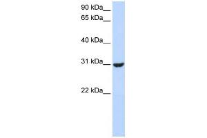 WB Suggested Anti-RNF182 Antibody Titration:  0. (RNF182 anticorps  (Middle Region))