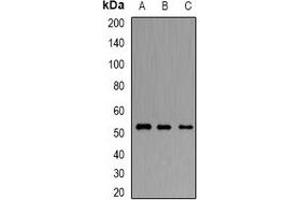 Western blot analysis of ORL1 expression in K562 (A), SW620 (B), U87 (C) whole cell lysates.